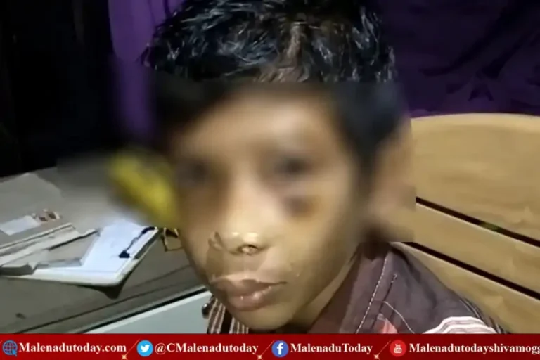 ಪೋಷಕರೇ ಎಚ್ಚರ! ಮನೆ ಮುಂದೆ ಆಟವಾಡ್ತಿದ್ದ ಬಾಲಕನಿಗೆ ಏನಾಯ್ತು ಗೊತ್ತಾ?