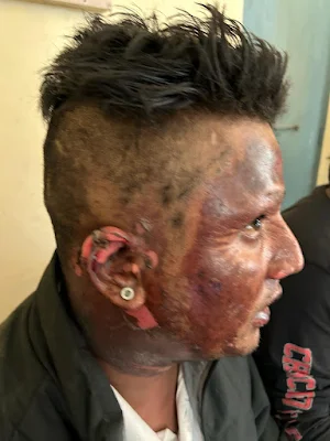 police shootout shivamogga today