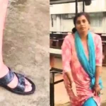 Stray Dog Attacks Government Employee  at jati ganati  