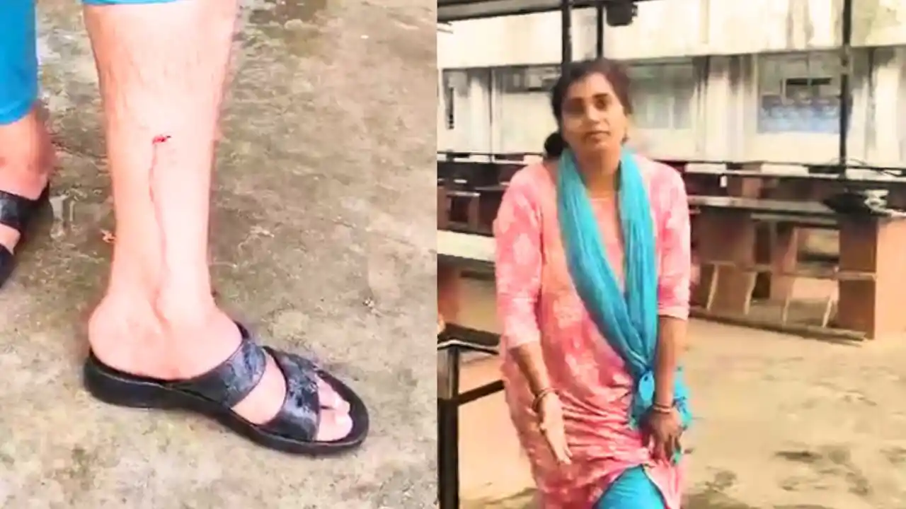 Stray Dog Attacks Government Employee  at jati ganati  