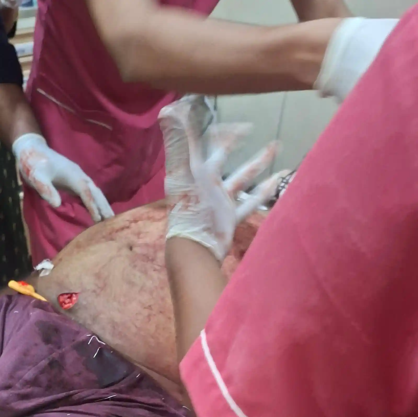  Scrap Businessman Amjad Attacked in Shivamogga