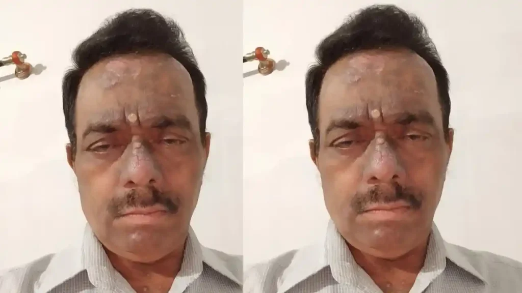 ಶಿವಮೊಗ್ಗ : 2 ರೂಪಾಯಿ ಡಾಕ್ಟರ್ ಬಿ.ಎಲ್.ಸುರೇಶ್ ತಳ್ಯಾಳ್ ಇನ್ನಿಲ್ಲ! 1 Who Will Fill the Void Left by Shivamogga’s '2 Rupee Doctor'?