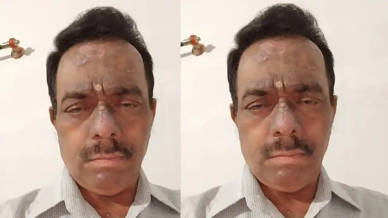 ಶಿವಮೊಗ್ಗ : 2 ರೂಪಾಯಿ ಡಾಕ್ಟರ್ ಬಿ.ಎಲ್.ಸುರೇಶ್ ತಳ್ಯಾಳ್ ಇನ್ನಿಲ್ಲ! 1 Who Will Fill the Void Left by Shivamogga’s '2 Rupee Doctor'?