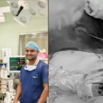 Nanjappa Life Care : High-Tech Success: Shivamogga Nanjappa Life Care Cures Liver Cancer