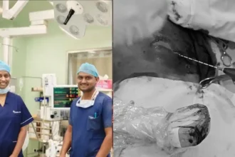 Nanjappa Life Care : High-Tech Success: Shivamogga Nanjappa Life Care Cures Liver Cancer