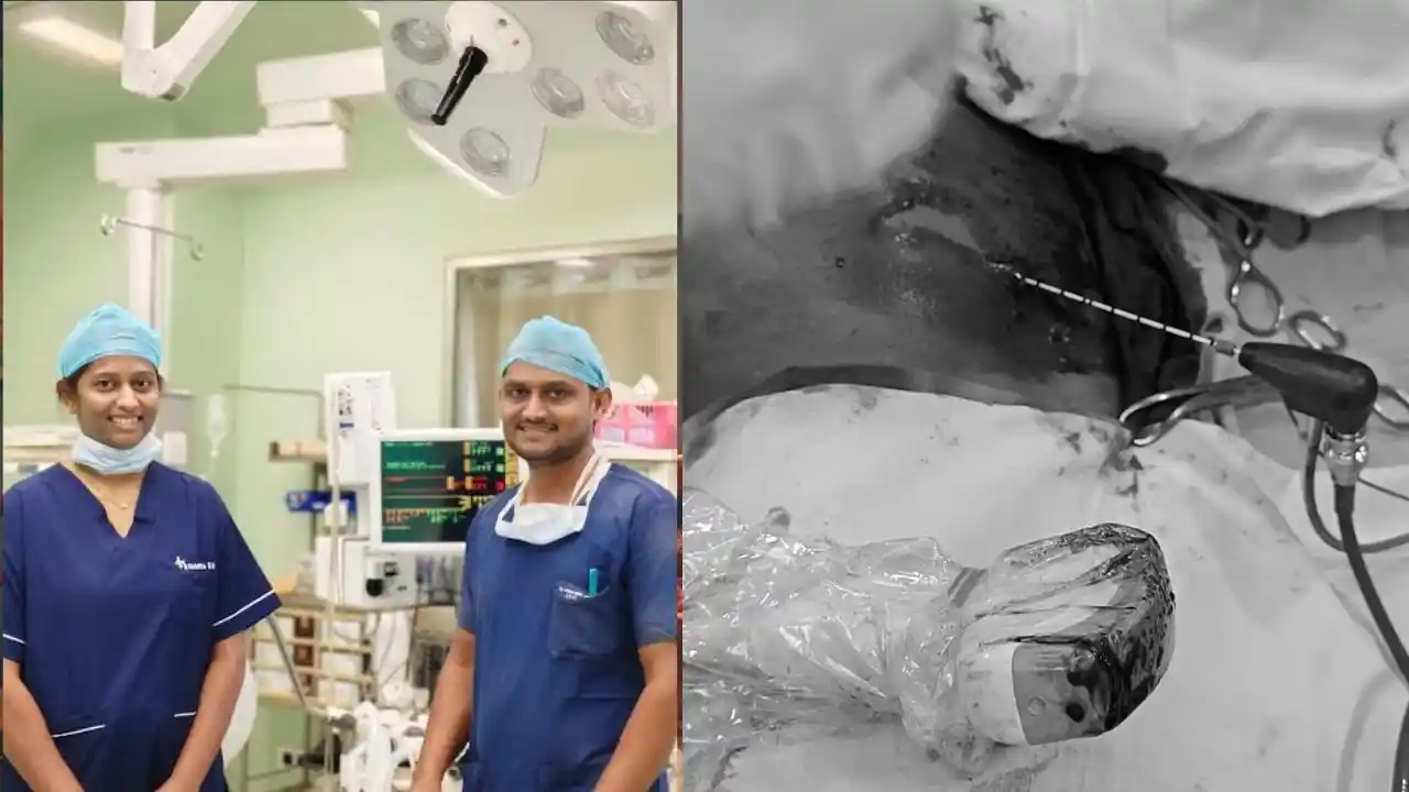 ನಂಜಪ್ಪ ಲೈಫ್ ಕೇರ್ ನಲ್ಲಿ ಮೈಕ್ರೋವೇವ್ ಅಬ್ಲೇಶನ್ ಮೂಲಕ ಆಪರೇಷನ್ ಯಶಸ್ವಿ! ವಿಶೇಷ ವಿಷಯವಿದೆ ಓದಿ! 4 Nanjappa Life Care : High-Tech Success: Shivamogga Nanjappa Life Care Cures Liver Cancer