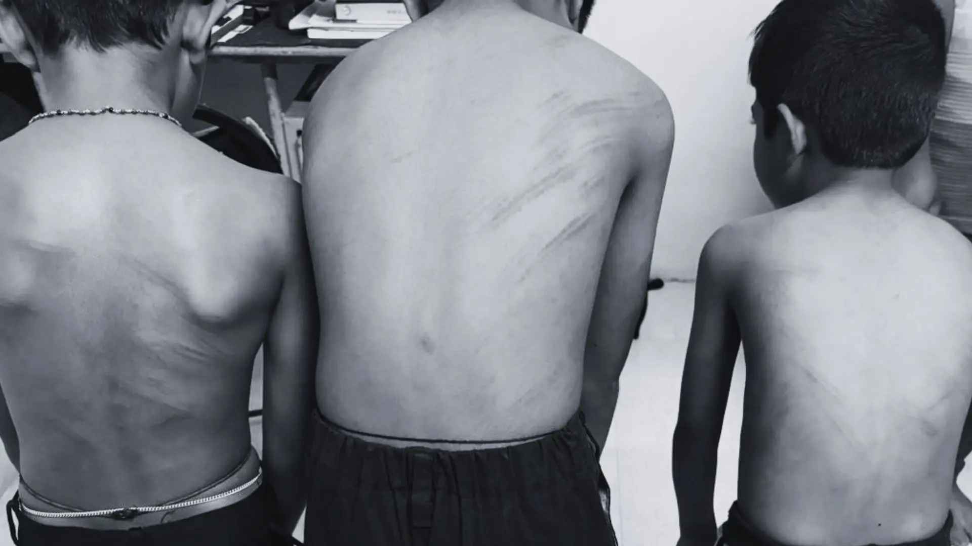 Parents Allege Guest Teacher Beat Three Students With Stick at Kiruvase Government School